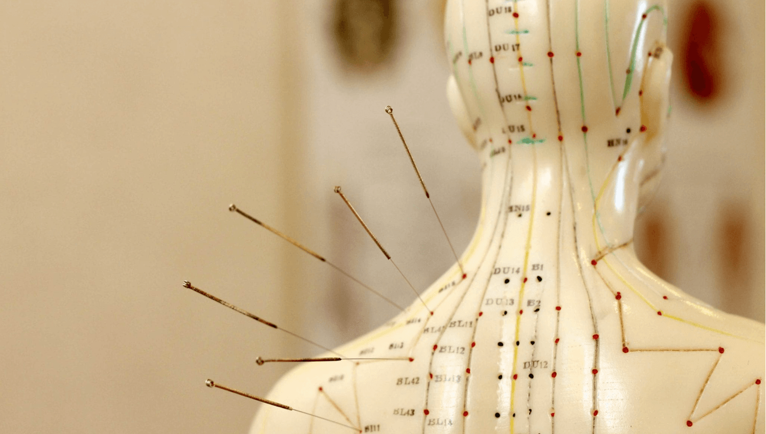 Image for Acupuncture 