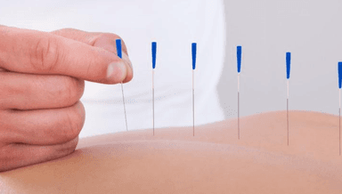 Image for Acupuncture follow up 