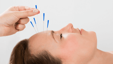 Image for Cosmetic acupuncture