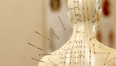 Image for Acupuncture Initial Assessment and treatment 
